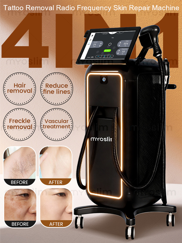 Industrial Laser Hair Removal Machine - Maszyna do depilacji laserowej 4 w