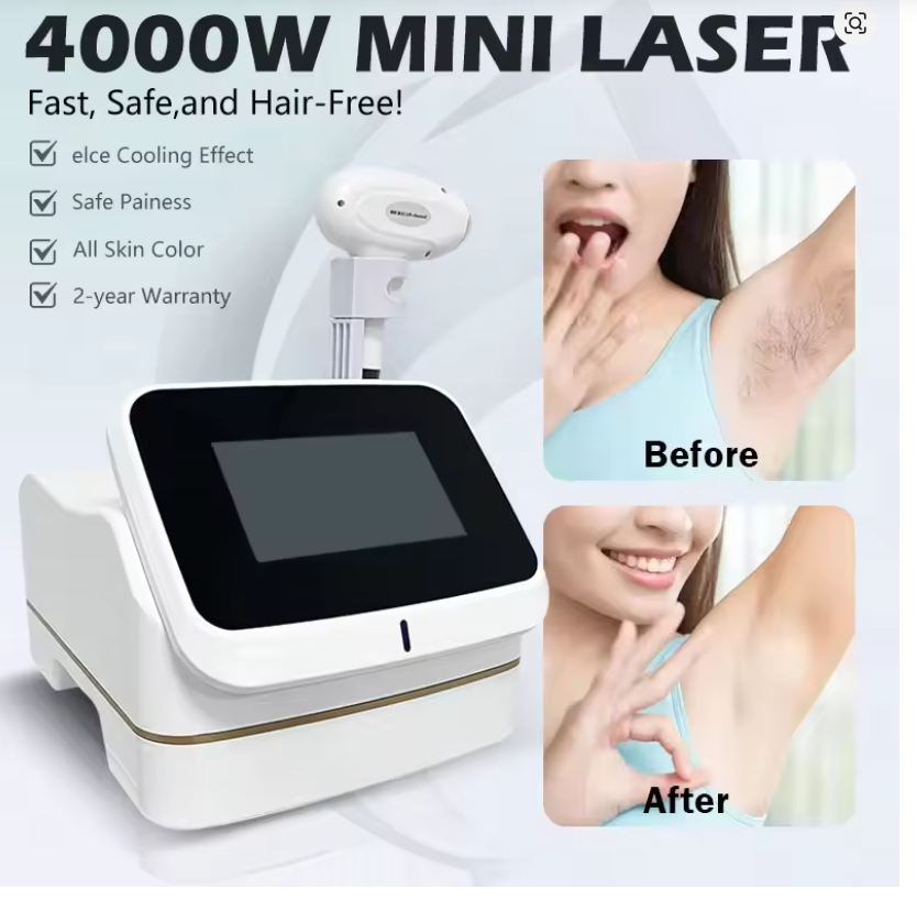 Industrial Laser Hair Removal Machine - Maszyna do depilacji laserowej 3 długości